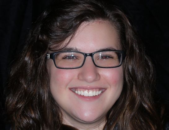 Trial Smiles Case 1 - After