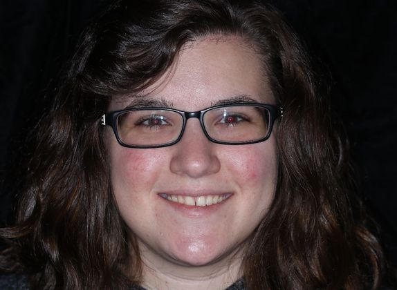 Trial Smiles Case 1 - Before