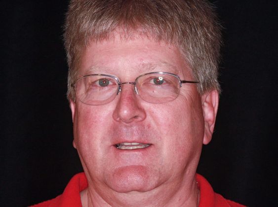 Trial Smiles Case 4 - Before