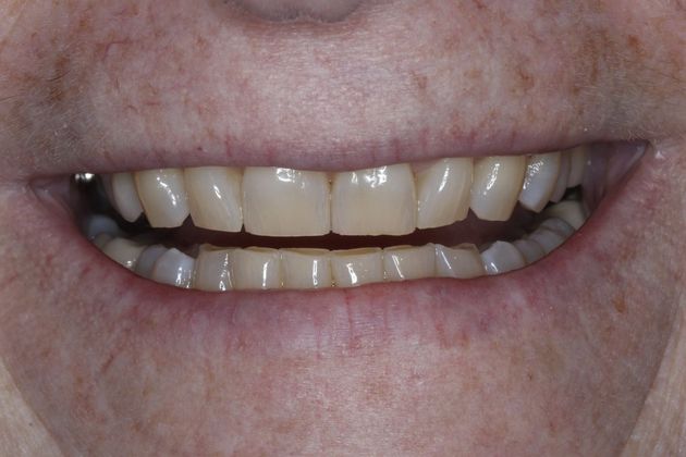 Trial Smiles Case 7 - Before