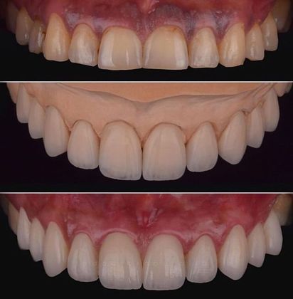 Before and Afters: Case 2 - Before, Model and Final