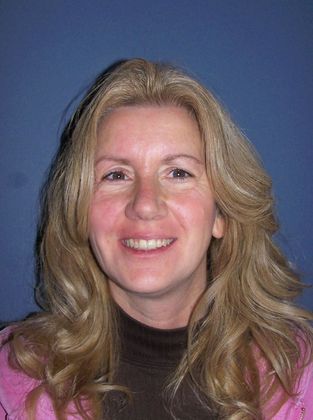 Senior: Senior Crowding - After