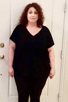  Patient Transformation Stories Rhonda Lost 118lbs!  - Before