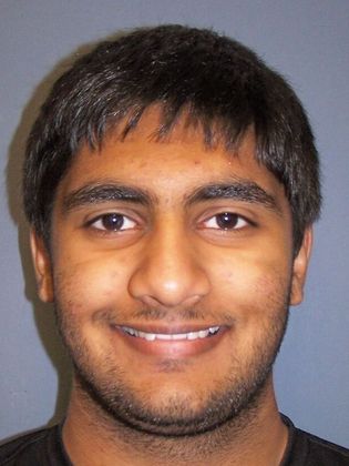 Open Bite Open Posterior Bite - Before