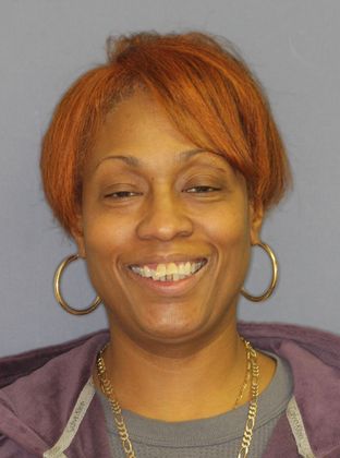 Senior: Over Bite - Before