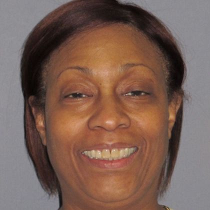 Periodontics and Braces: Over Bite - After