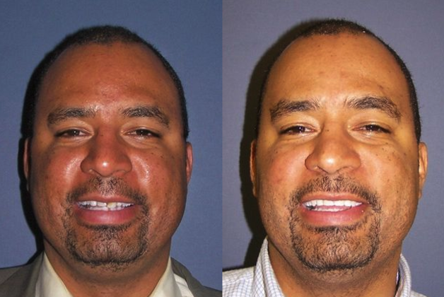 Periodontics and Braces Cases