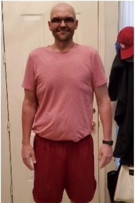 Patient Transformation Stories: Adam Lost 200 lbs with DAVINCI Bariatric Surgery! - After