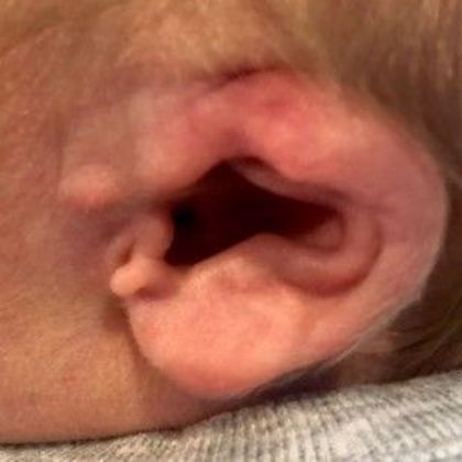 Ear Molding Case 53 - Before