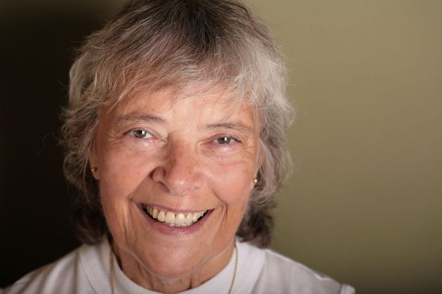 Porcelain Crowns: Case 6 - After