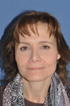 Facelift Facelift and rhinoplasty can be combined - After