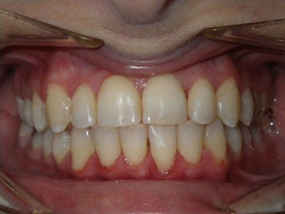 Orthodontics: Case 1 - After