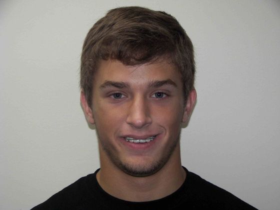 Orthodontic and Implant: Case 1 - After