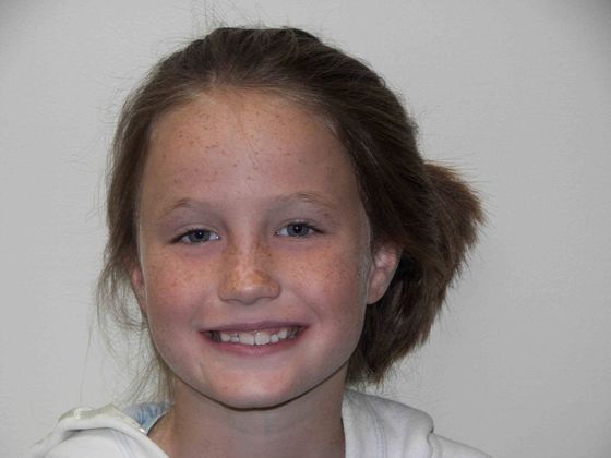 Orthodontics: Case 2 - Before