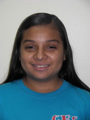 Orthodontics: Case 3 - Before