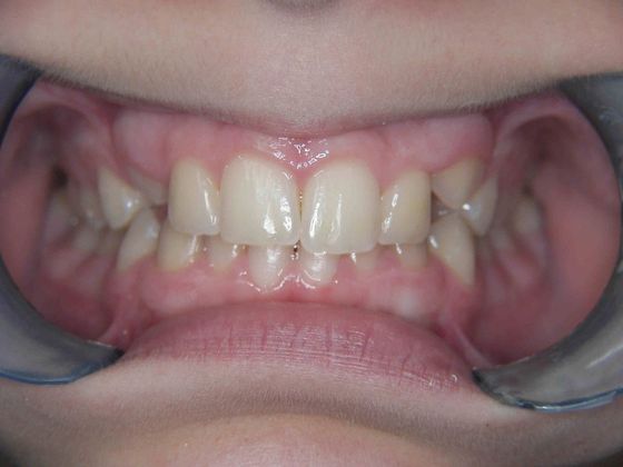 Orthodontics: Case 7 - Before