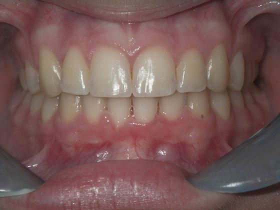 Orthodontics: Case 7 - After