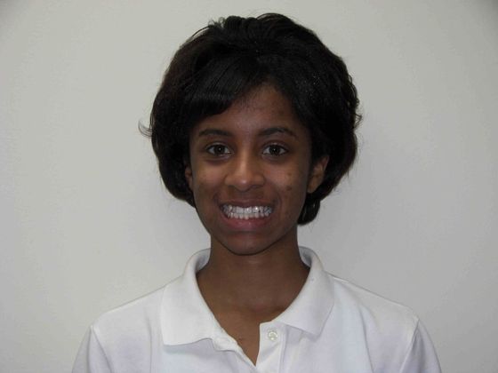 Orthodontics: Case 8 - Before