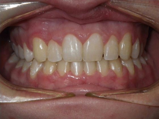 Orthodontics: Case 5 - After
