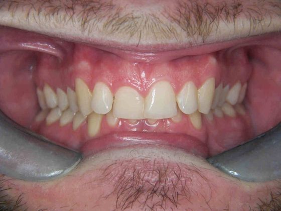 Orthodontics Case 12 - Before