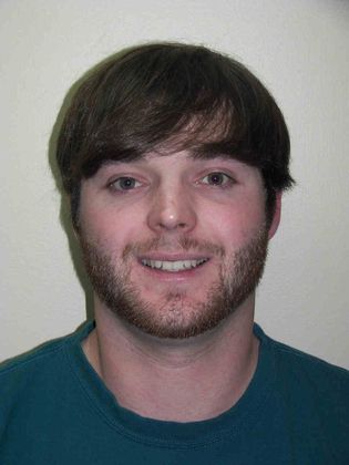 Orthodontics Case 12 - After