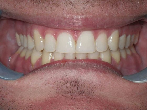 Orthodontics: Case 12 - Before