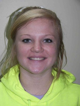 Orthodontics: Case 14 - After