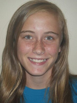 Orthodontic treatment in Phases: Case 1 - Before