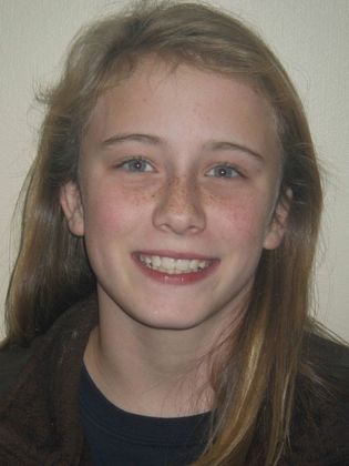 Orthodontic treatment in Phases: Case 1 - After