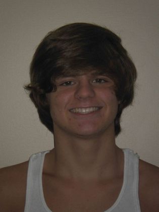 Orthodontic treatment in Phases: Case 2 - After