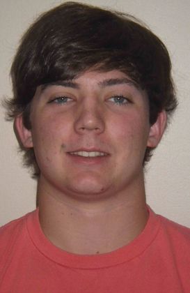 Orthodontic treatment in Phases: Case 4 - After