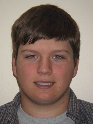 Orthodontic treatment in Phases: Case 5 - After