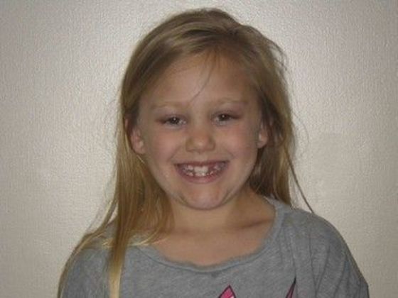 Orthodontic treatment in Phases: Case 6 - Before