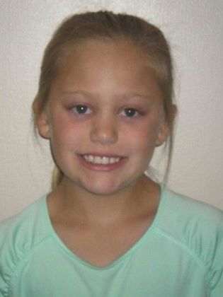 Orthodontic treatment in Phases: Case 6 - After