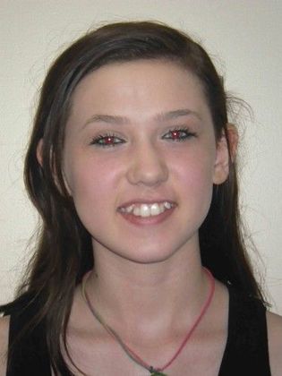 Orthodontics: Case 17 - Before