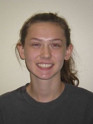 Orthodontics: Case 17 - After