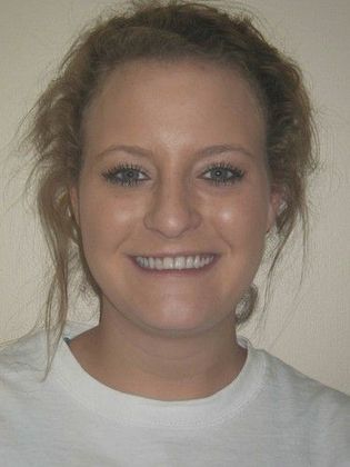 Orthodontics: Case 18 - Before