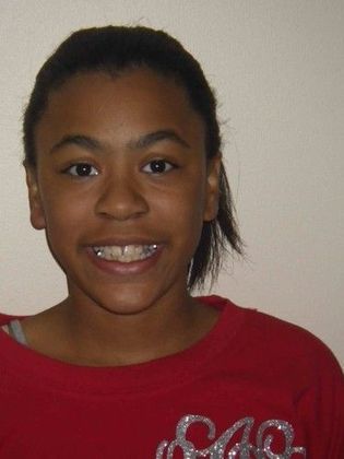 Orthodontics: Case 19 - Before