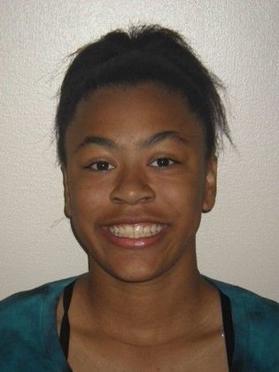 Orthodontics: Case 19 - After