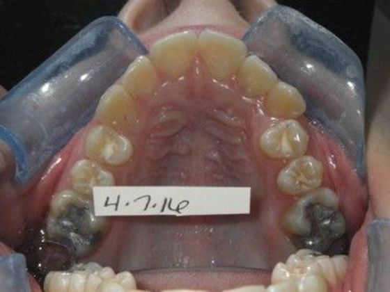 Orthodontics: Case 21 - Before