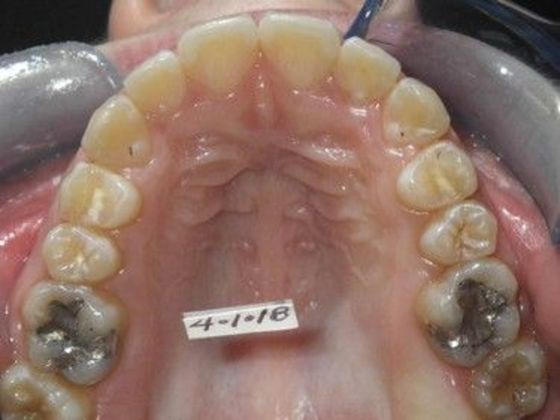 Orthodontics: Case 21 - After