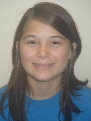 Orthodontics: Case 22 - Before