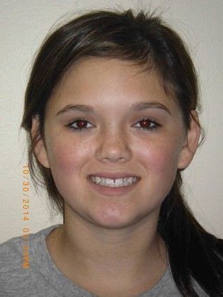 Orthodontics: Case 23 - Before