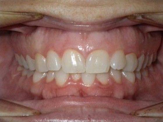 Orthodontics: Case 24 - Before