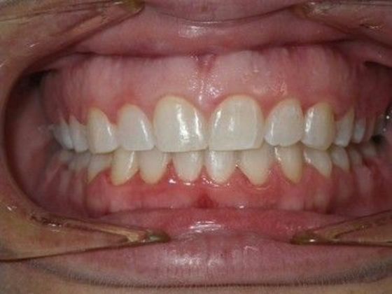 Orthodontics: Case 24 - After