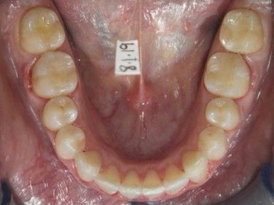 Orthodontics: Case 24 - After