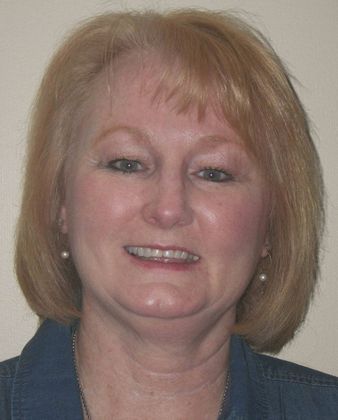 Full Mouth Reconstruction: Case 1 - Before