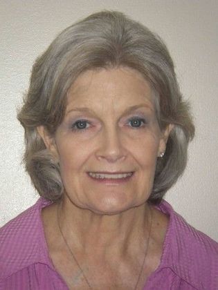 Full Mouth Reconstruction: Case 2 - After