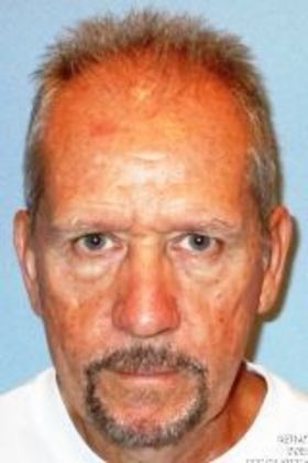 Direct Eyebrow Lift Surprise Resident Thrilled - Before