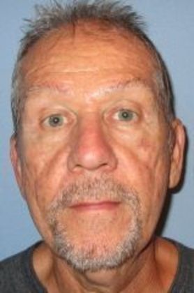 Direct Eyebrow Lift Surprise Resident Thrilled - After